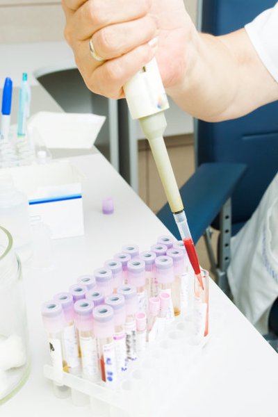 新乡借卵试管助孕公司：男性和女性的高效血液测试