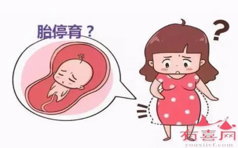 昆明助孕产子：怀孕早期流产的4个最明显迹象是什么？